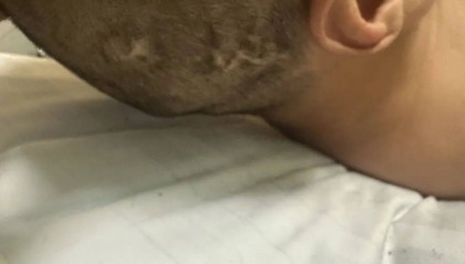 4名游客景区内遭马蜂袭击，旅游度假区：是森林公园不卖门票，蜇伤先就医后提供证据投诉