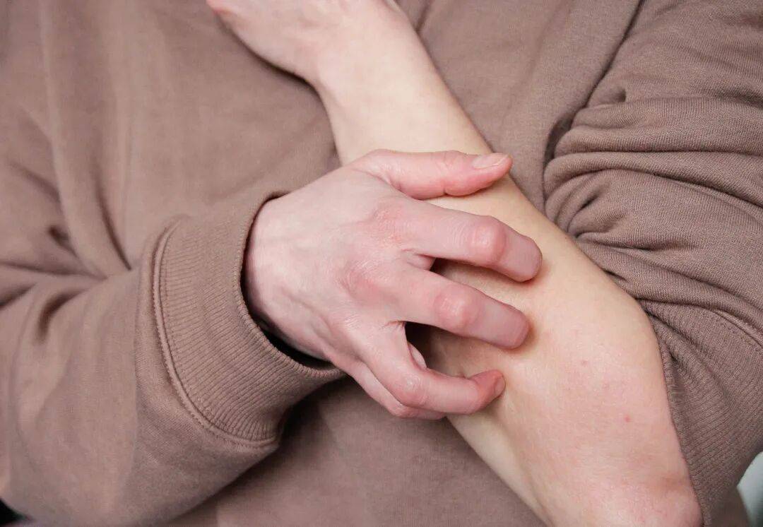 事发上海街头！女子突然浑身肿胀，陷入昏迷...医生：建议随身携带肾上腺激素笔